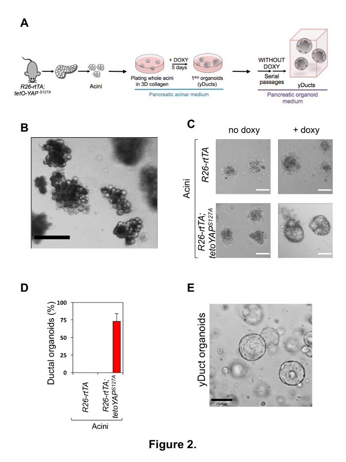 Pancreatic acini organoid formation diagram with microscopy images and ductal organoid graph.