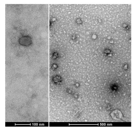 Electron microscopy, nanoparticle distribution; high-resolution imaging; nanometer scale analysis.