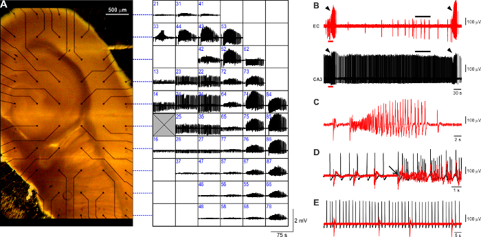 Brain electrophysiology diagram with electrode mapping and neural activity recordings for signal analysis.