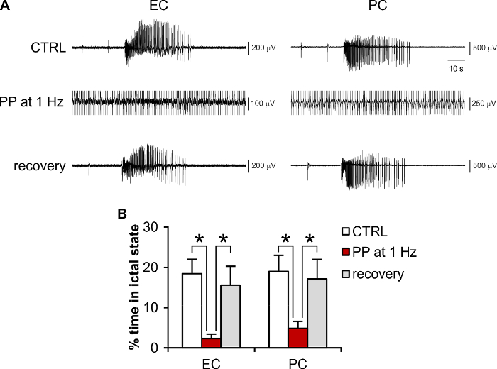 Seizure activity analysis diagram; graphs showing changes in ictal state under CTRL, PP at 1 Hz, recovery.