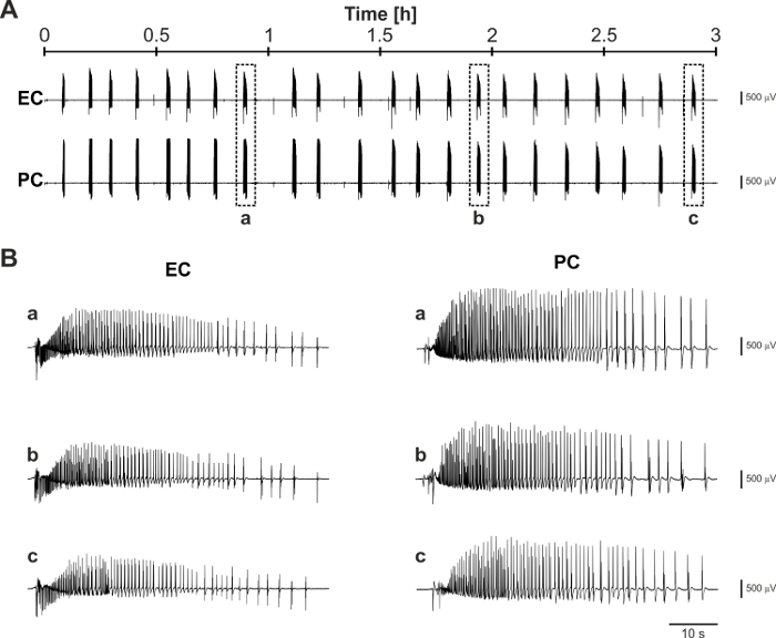 Electrophysiology graph; EC and PC signal patterns; time-series, amplitude analysis, waveform comparison.