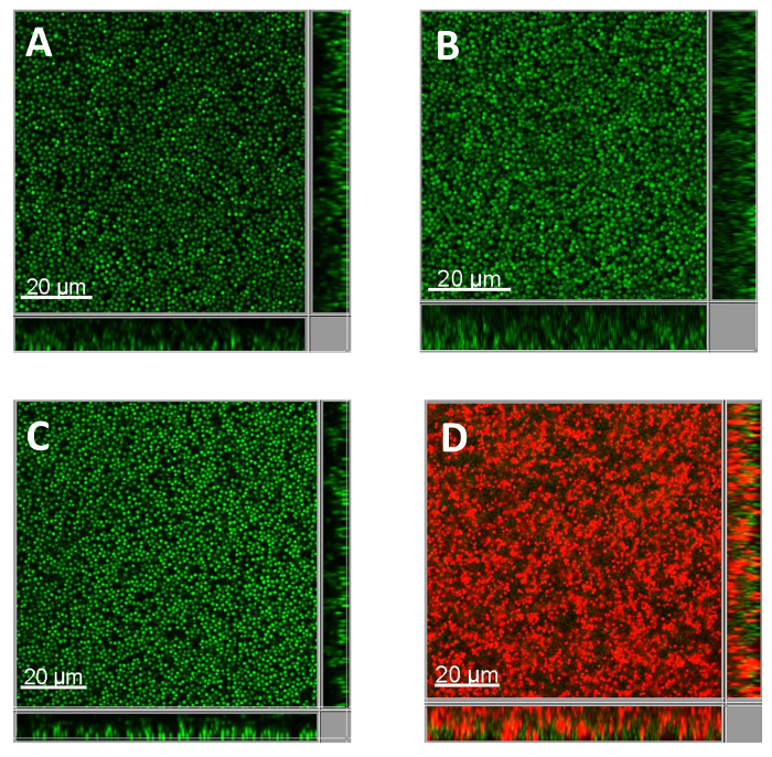 Confocal microscopy images of cellular fluorescence; four panels, green and red fluorescence.