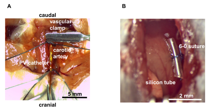 Surgical procedure diagram showing PV catheter and vascular clamp on carotid artery with silicon tube.
