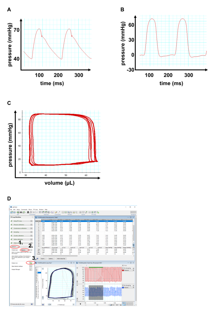 Pressure-time and pressure-volume graphs; software analysis interface for data modeling.