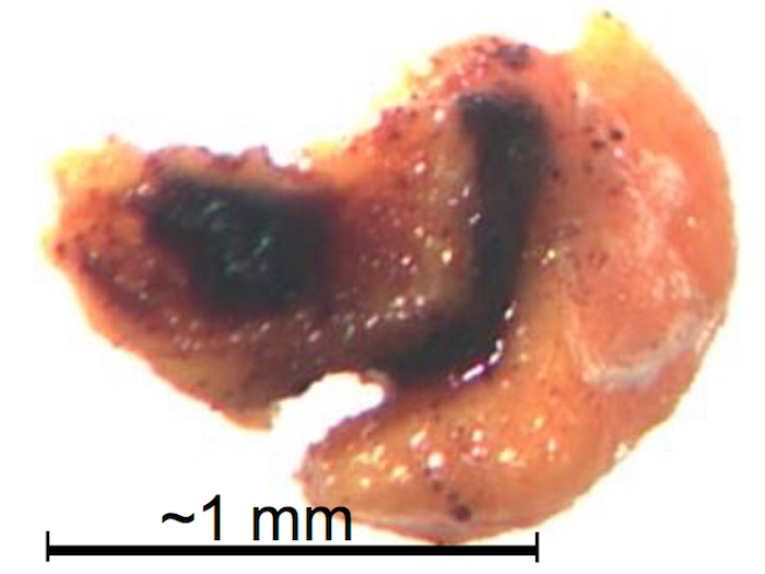 figure-results-15 Tissue sample close-up (~1mm) showing burn damage, used in forensic analysis and material testing.