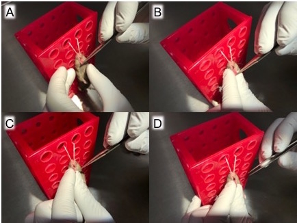 Gloved hands demonstrating tissue sample extraction process using dissecting tools and a holder.