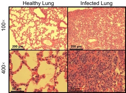 Lung tissue histology comparison, healthy vs. infected, microscope images at 100x, 400x magnification.