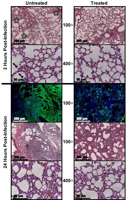 Histology micrographs comparing untreated and treated cells post-infection at 100x, 400x magnification.