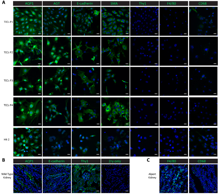 figure-results-2 Immunofluorescence microscopy, protein markers (AQP1, AGT, E-cadherin), kidney cell analysis.