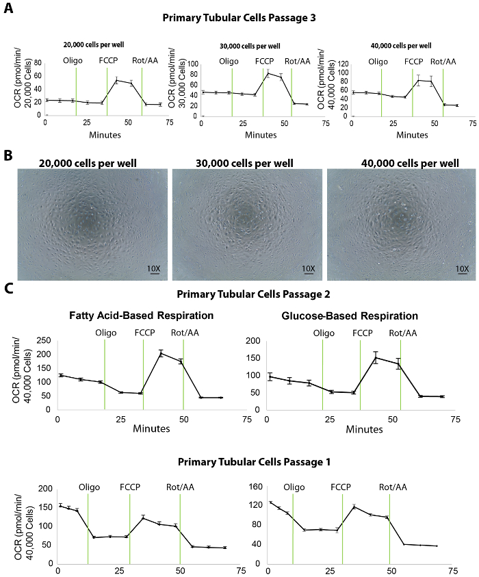 figure-results-3 Primary tubular cells respiration graphs; passage 1-3; oxygen consumption rate; microscopy images.