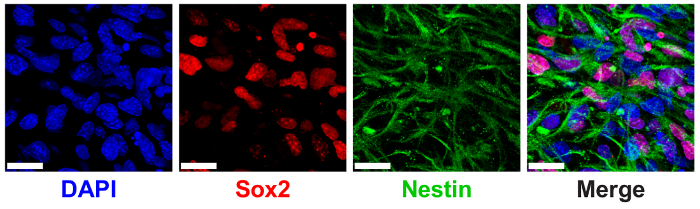 Immunofluorescence microscopy image; DAPI, Sox2, Nestin staining, cell differentiation analysis.