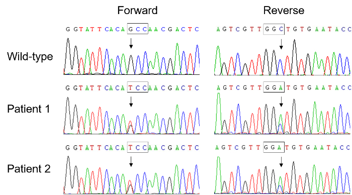 figure-results-2 DNA sequence chromatogram; patient vs wild-type; mutation analysis; diagram.