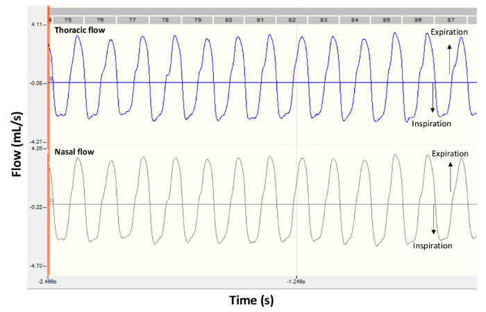 figure-results-2 Respiratory flow graph; thoracic, nasal flow; inspiration, expiration cycles; time vs. flow chart.