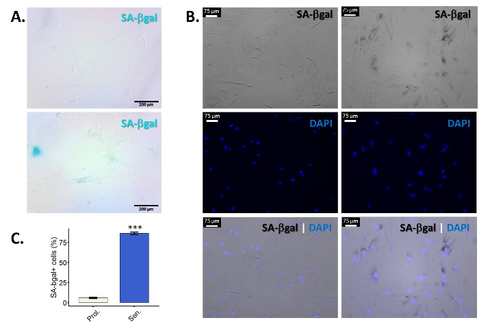 Senescence-associated β-galactosidase assay; microscopy images, DAPI staining, and quantitative graph.