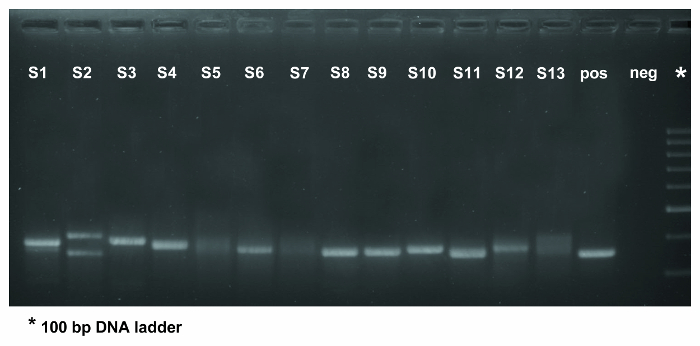 figure-results-3 Gel electrophoresis; DNA separation; lanes S1-S13; 100 bp DNA ladder; experiment result.