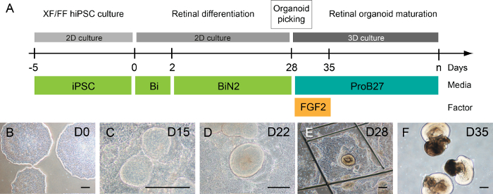 Retinal differentiation timeline: organoid maturation, iPSC to ProB27; microscopy images.