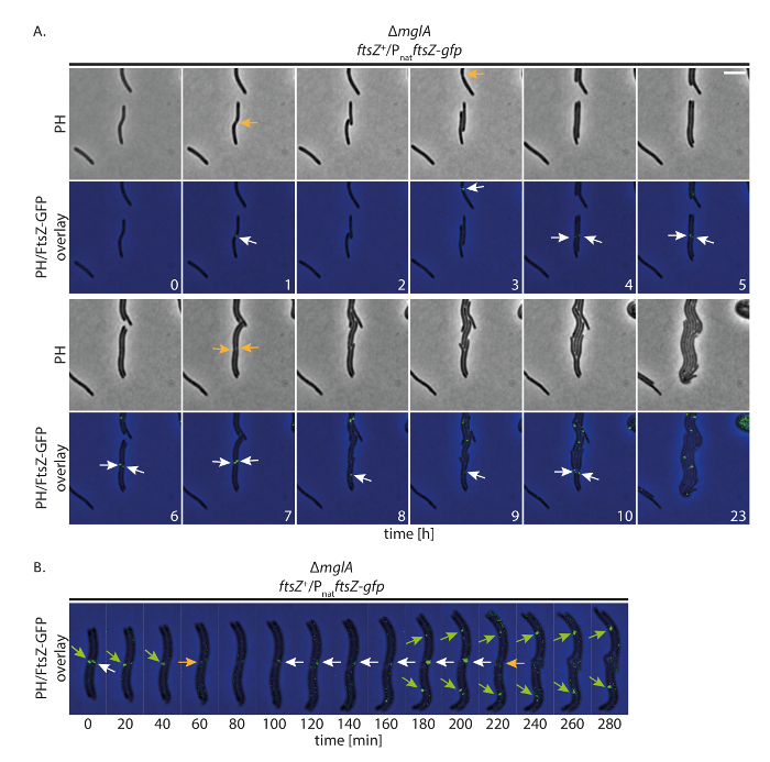 figure-results-5 Bacterial cell division timeline with fluorescent protein markers; time-lapse microscopy analysis.