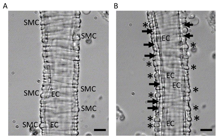 Microscopic analysis of plant stem cells, diagram showing cell structure labeled SMC and EC