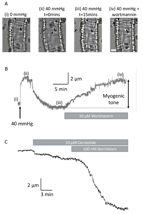 Vascular myogenic tone analysis; light micrographs, pressure changes, drug effects; charted response.