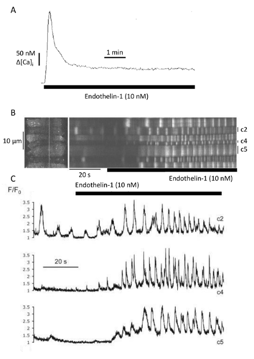 Calcium signaling response to Endothelin-1, graph analysis, microscopy and electrophoresis results.