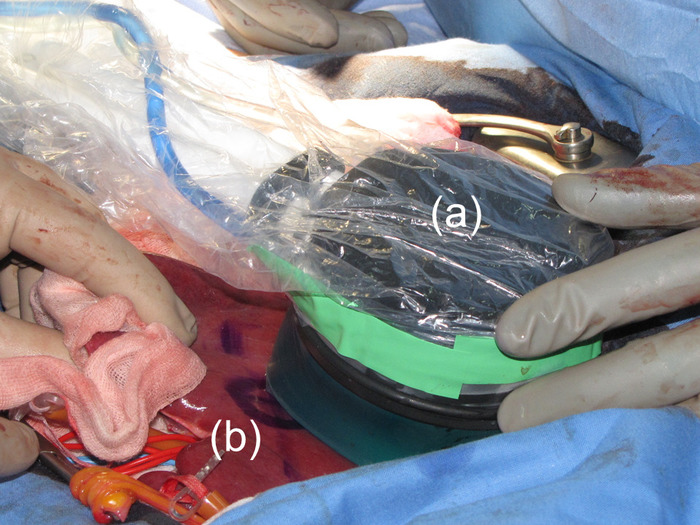 figure-results-2 Surgical procedure setup showing covering materials and tools in sterile field.