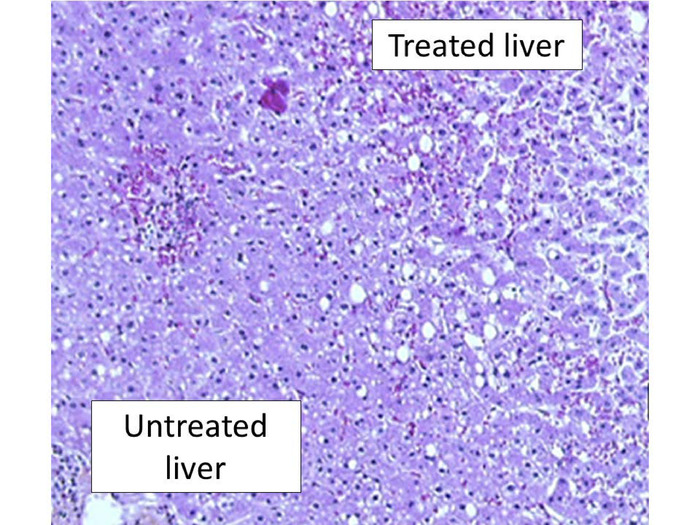 figure-results-8 Liver tissue histology, treated vs untreated, microscope image showing cellular structure changes.