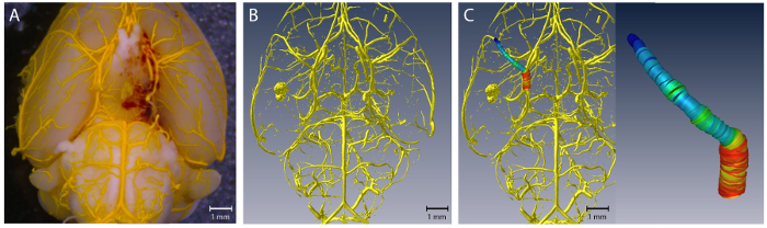 Brain vasculature diagram, showing segmented 3D models, highlighting vascular network structures.