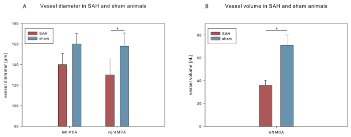 Bar graphs comparing vessel diameter and volume in SAH vs. sham animals, showing significant differences.