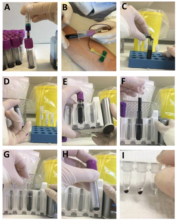 Blood collection and separation process; tube handling, centrifuge setup, sample preparation sequence.