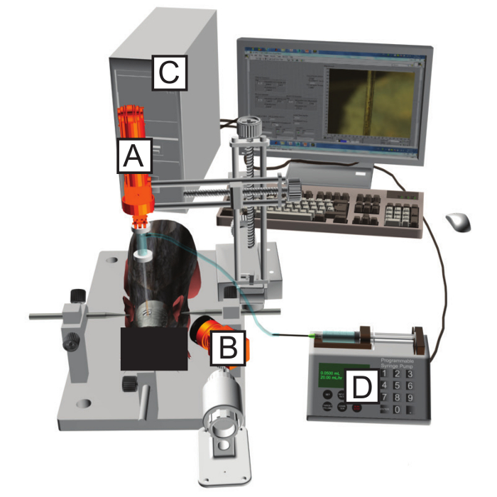 Neurosurgery setup diagram with robotic arm, stereotactic frame, syringe pump, and computer control.