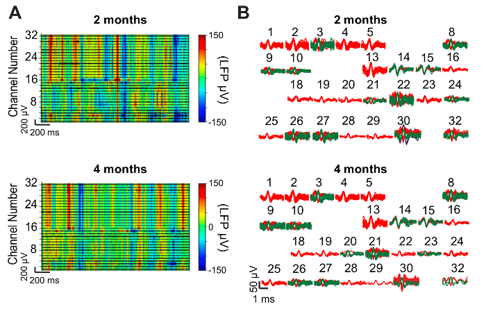 Neural activity comparison, LFP matrix heatmap, line graph, 2 and 4 months, electrophysiology.