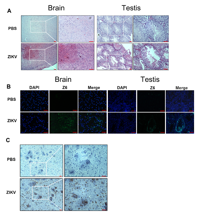 Brain and testis histological comparison using DAPI and ZIKV in microscopy panels A, B, C.