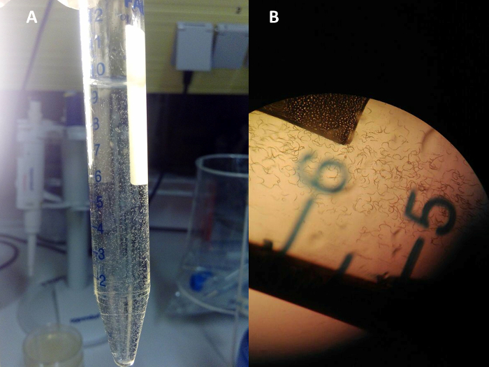 Test tube with liquid in centrifugation; microscopic view of sample analysis.