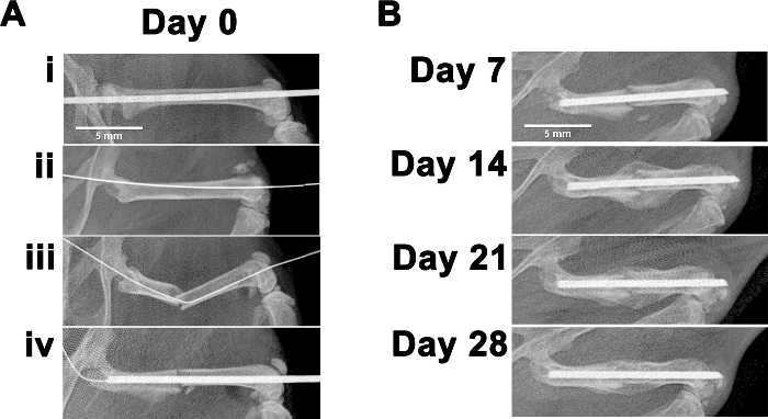 Bone healing process; X-ray images; fracture healing over time; Day 0 to Day 28; orthopedic study.