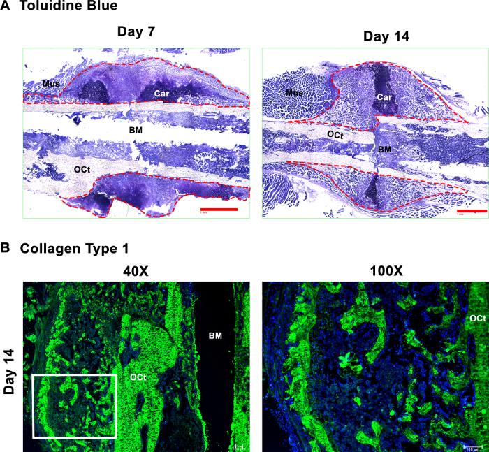 Toluidine blue staining; cartilage tissue repair, day 7 and 14, microscopy images, collagen analysis.
