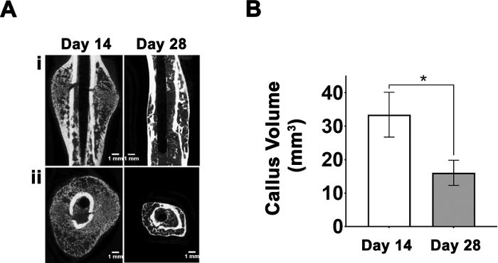 Bone healing analysis with CT scans and callus volume chart over days 14 and 28; healing progress.