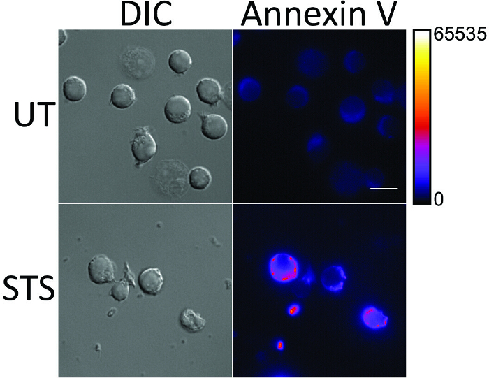Annexin V 检测显微镜图像、DIC 图像、细胞凋亡分析、荧光强度标尺