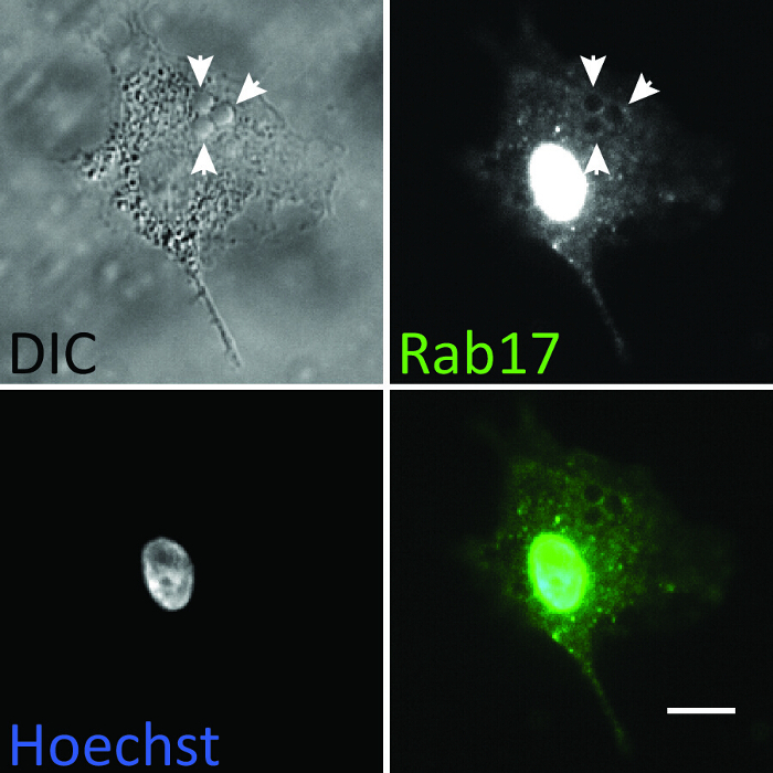 细胞中Rab17蛋白的共聚焦显微镜图像；微分干涉差（DIC）、Hoechst、荧光标记分析。