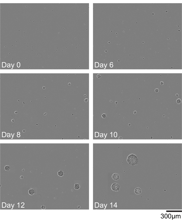 figure-results-1 Cell growth over 14 days; microscope images chronicle gradual aggregation increase; scale bar 300μm.
