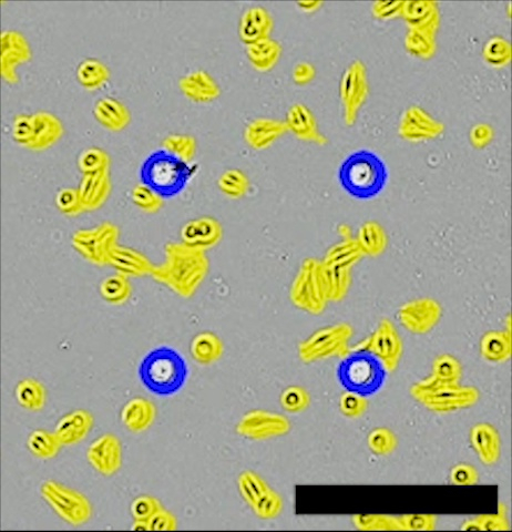 figure-results-3 Microscope image of cell culture analysis showing stained yellow cells with blue nuclei for research.