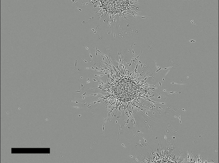 figure-results-6 Neural stem cell clusters, phase-contrast microscopy, cell differentiation, regenerative medicine.