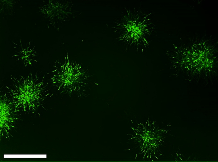 figure-results-7 Fluorescence microscopy image of neural stem cell spheres, cellular distribution assessment.