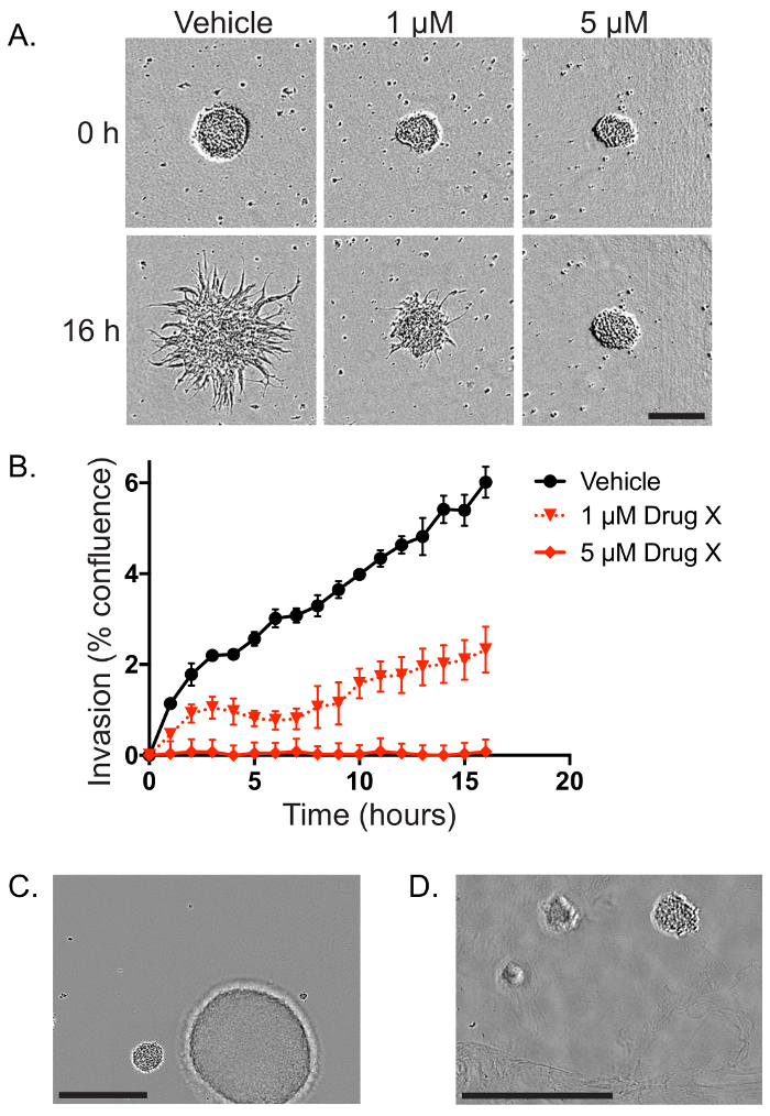 figure-results-8 Cell invasion assay: microscopy images with 0, 1, 5 μM drug, graph of confluence over 20 hours.