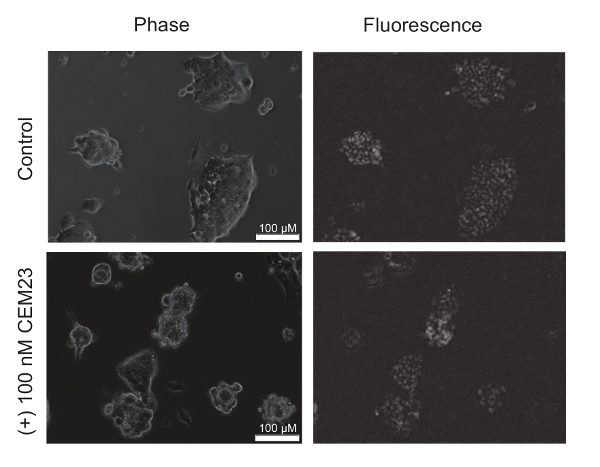 Cell comparison under phase contrast and fluorescence microscopy; control vs. 100 nM CEM23 treatment.