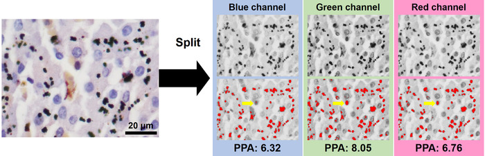 figure-protocol-1 Cell image RGB channel split; microscopy image analysis; blue, green, red channels with PPA values.