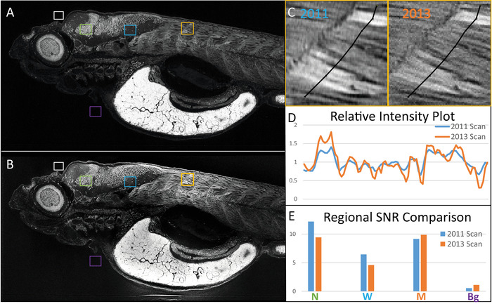 MRI analysis diagram; intensity plot, SNR comparison of brain scans from 2011 and 2013.