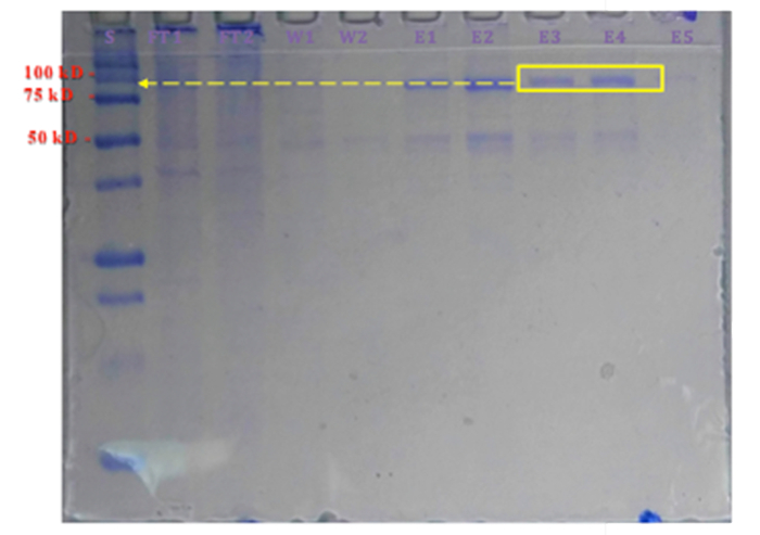 SDS-PAGE electrophoresis gel showing protein separation with molecular weight markers at 100kD, 75kD.