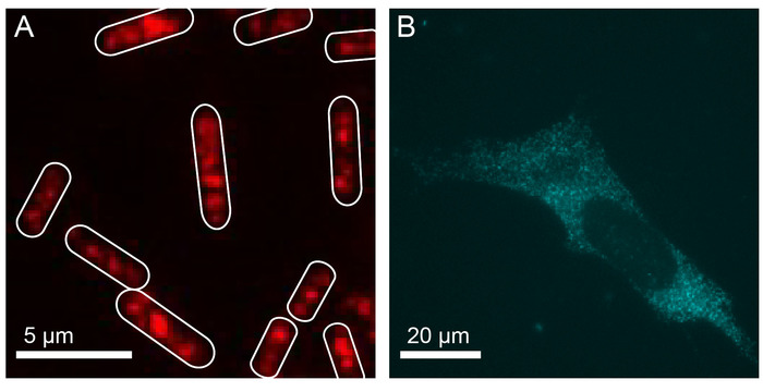 Video: Conducting Multiple Imaging Modes with One Fluorescence Microscope