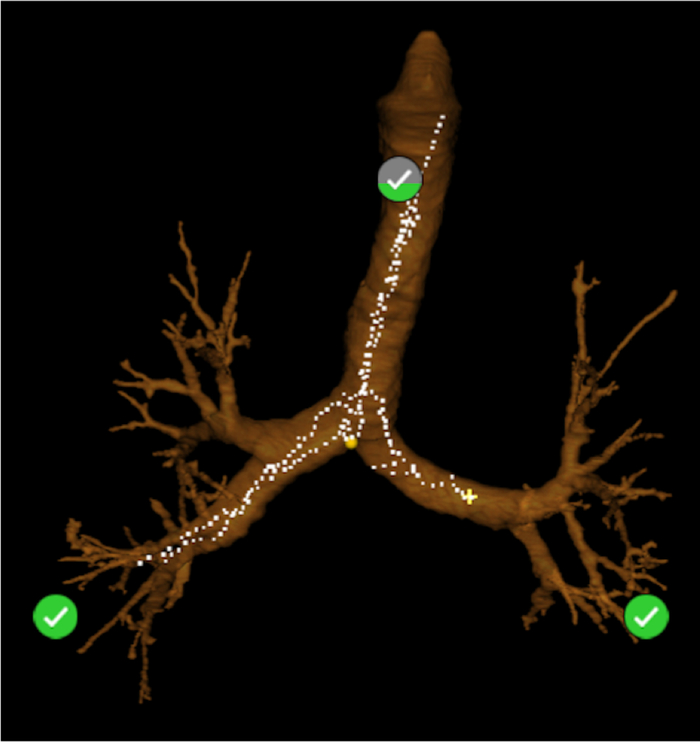 Bronchial tree 3D visualization, anatomy diagram, airway segmentation, medical imaging analysis.