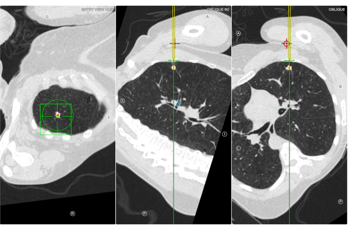 CT scan lung images; axial, sagittal, coronal views; diagnostic imaging; pulmonary assessment.